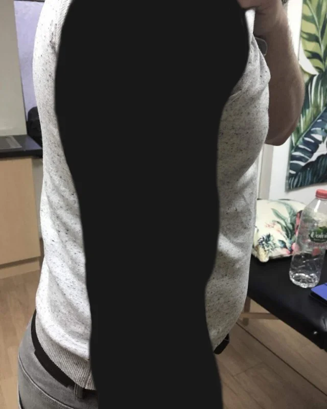 fUmdMr1.webp