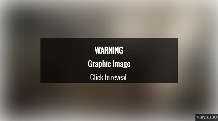 lhdsYdc.webp